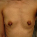 Before front view - gosh, I hate looking at my ribs.