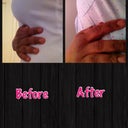 Before/after