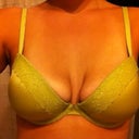 Saggy, deflated 34DD