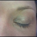 Left Eye, Week 0
