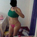 18 days post-op