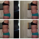 2 Week Post Side