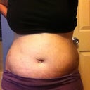 3 weeks post op - you can see how the swelling came and went  a LOT