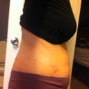swelling at 3 weeks - came and went a lot!