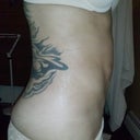 Side view 6weeks.. after seeing Suzzane