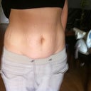 my 3 year old took this picture for me then told me I had a zebra belly