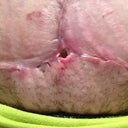 My hole :(