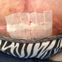 my PS sewed me back up this morning
