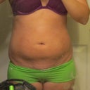 Front 1 Month After (Not Sucking In)