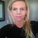 4 days after surgery...every day a little better!