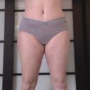 1 month after laser lipo