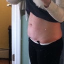 abs 2