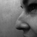 Left side nose/eyelid PreOp.