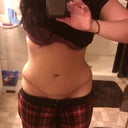 3 months post op