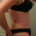 18 days PO blurry side view - swelling is there but getting better