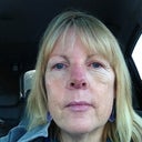 Driving home from cast removal. Really swollen but clearly a new nose...