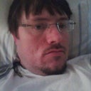 Me n 2011 before my first vile of sculptra