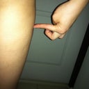I did vaser again on April 26, 2012; waist, back and ...as you see on my body.  I am not do inner thigh yet because my friend told me quite hurt but i will do anyway.  I feel like i have a strong tumor inside my abdominal and waist so, i had massage 2 hours a week both aromatherapy hand massge and thermage machine(not sure what does it call in other country). This time not hurt, i can driving myself home and do everything like normal day. Wanna let you guys know Vaser is worth!!!