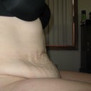 Morning before surgery