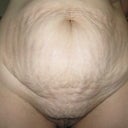 Front shot morning before surgery