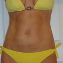 pre mm, flexing stomach in.  Vertical scar was because of the saggy stretched skin directly above my belly button, not because she couldn't get enough of the skin below