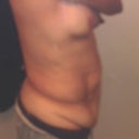 Before- Side View 11/14/12
