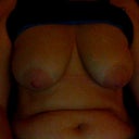 2 weeks pre op and saggy