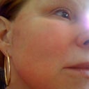 Post Pearl Day 5--much better!