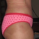 1 month post op