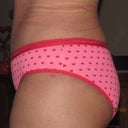 1 month post op