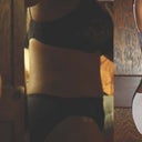 Right side comparison photos: Pre-Op, 5 days and 4 weeks.