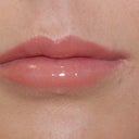 Alloderm Lip Implants