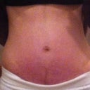 5wks , would be soooo sooo much happier if I didn't have the vertical scar.
