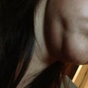 Hanging chin and jowl