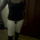 Front - 10  Days Post Op