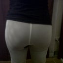 Butt Lift with 600 cc each Cheek - 10 days post Op