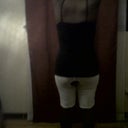 Back - 10 days Post Op