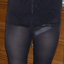 16 days post op with compression garment on
