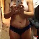 Day 21 still swollen but slowing losing.