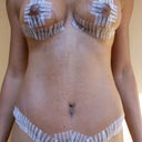 Front and BB, 2 wks PO