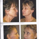 top:before
bottom:after