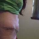right side 2wks out