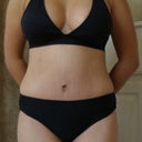 5 weeks post op.