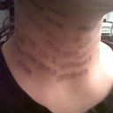 Neck; Day after IPL 11/19/11
