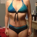 1 month post op