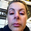 24 hours after