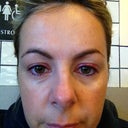24 hours after