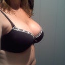 7 weeks Post Op