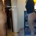 Post op 21 Days; Loving my new butt!