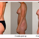 before, 2 weeks, 4 weeks